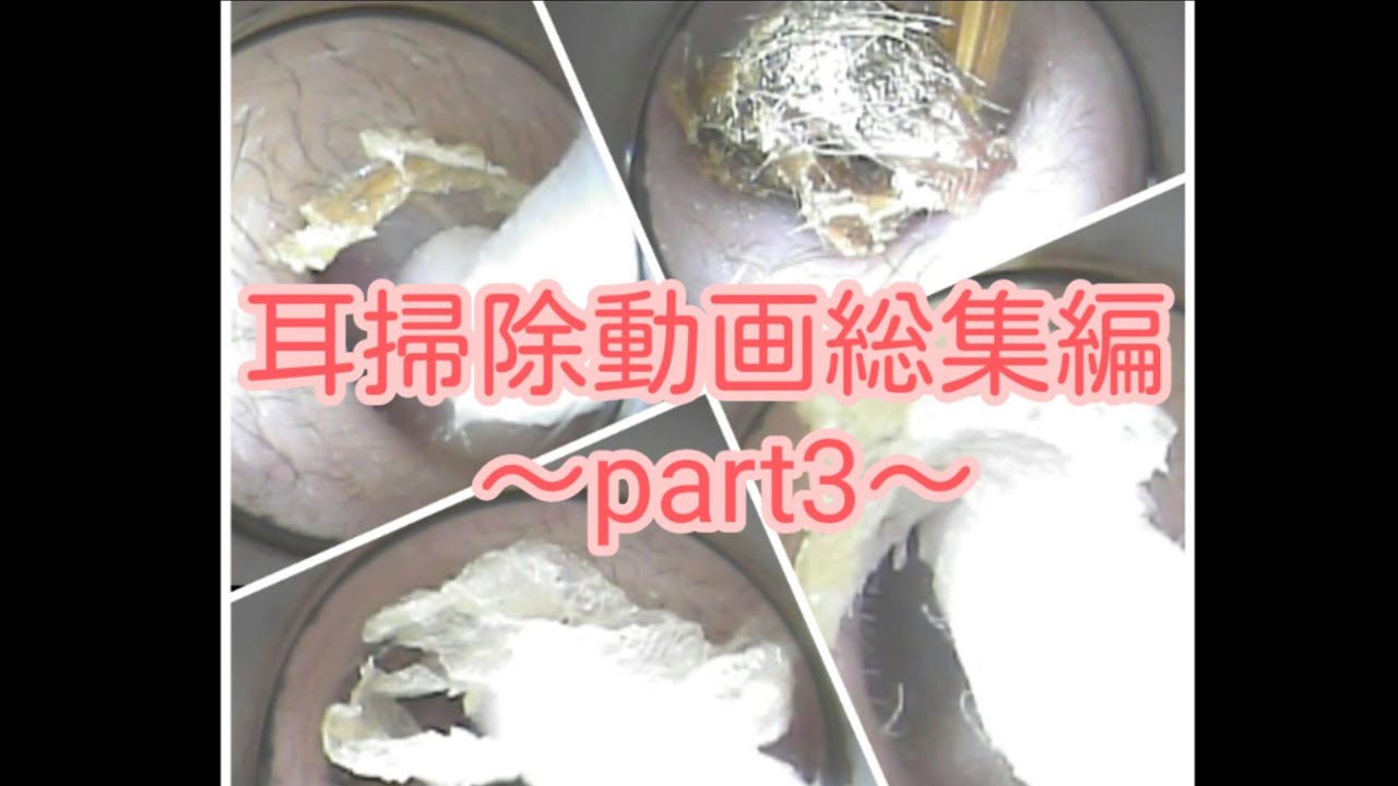 耳掃除動画総集編　～part3～　(ear wax removal)イヤーエステサロンVillalo～ヴィラロ～