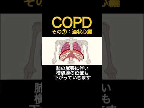 COPDってなに⑦〜滴状心って知ってるかいぼくは知らなかったよ〜　#作業療法士 #呼吸 #理学療法士 #看護師